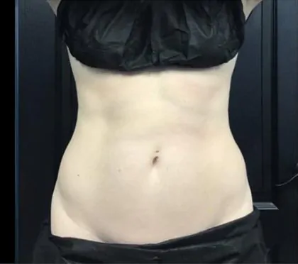 bna case