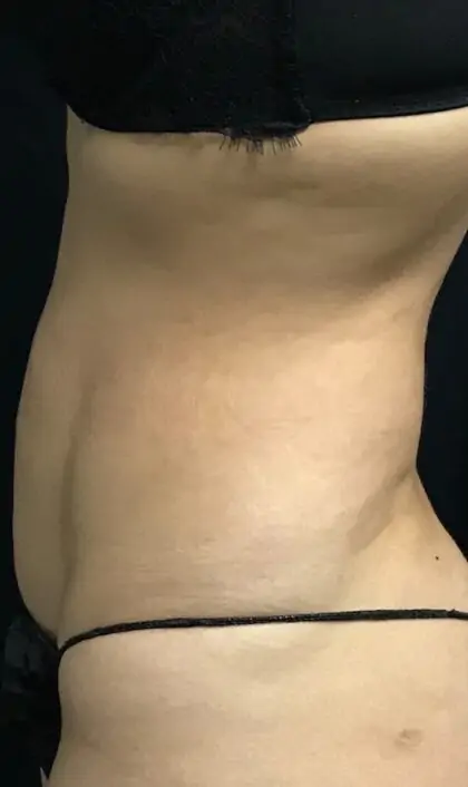  bna image