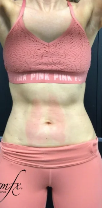Case 2 after photo