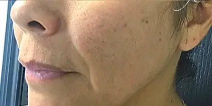 bna case