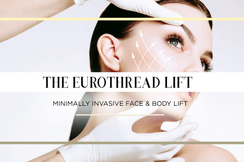 EuroThread Lift