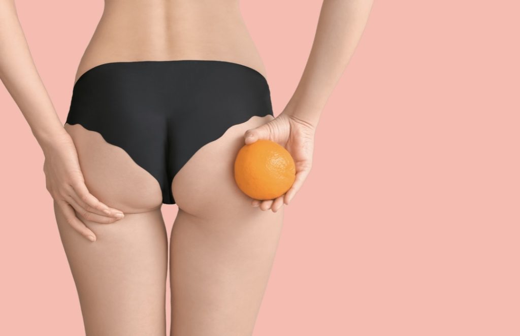 Cellulite Treatment - What Works Best?, DermFx