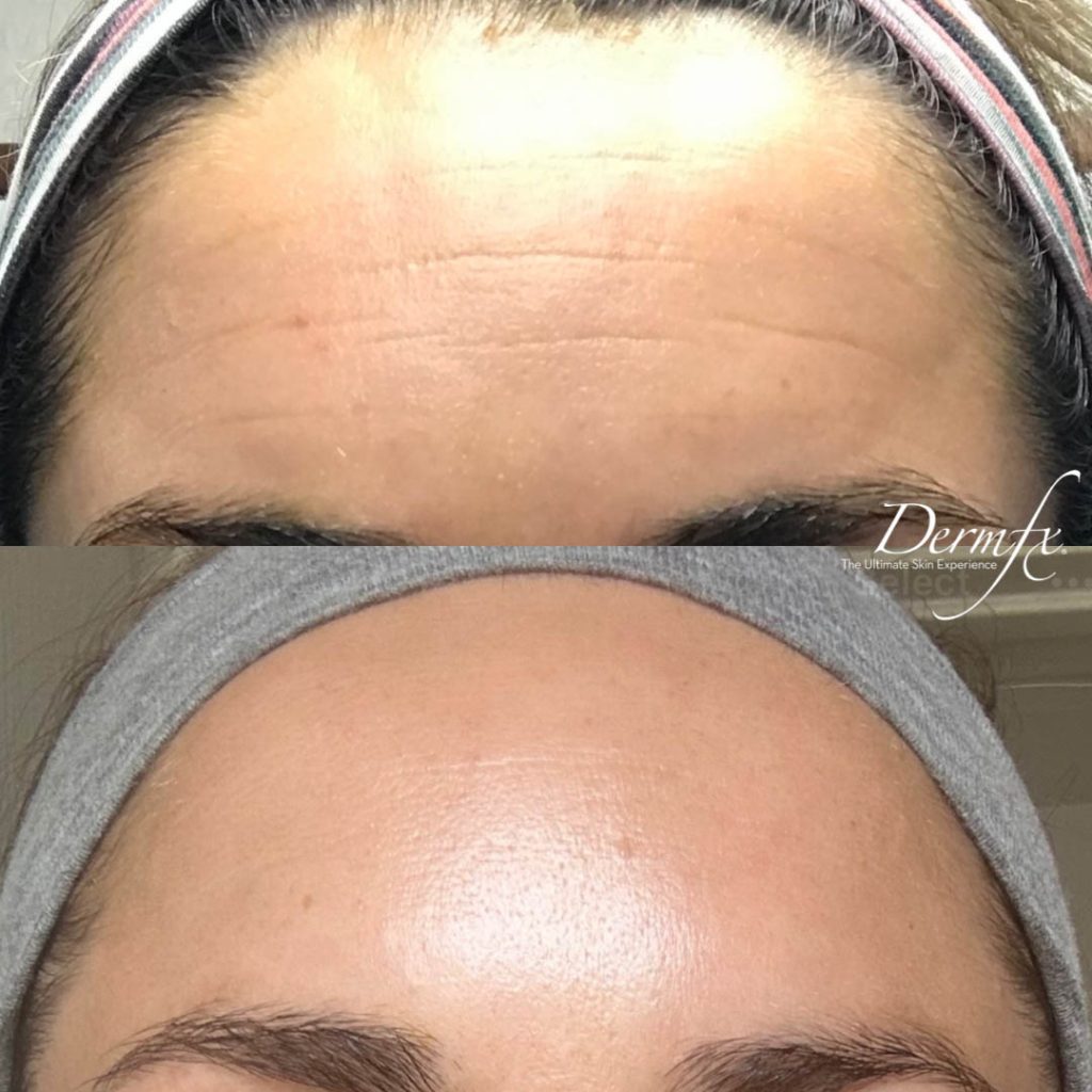 DAXXIFY Dermfx